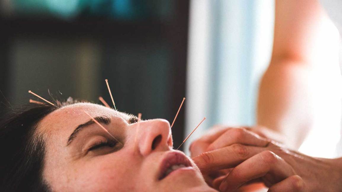 Treatment Administered by a Registered Acupuncturist