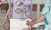 Treatment for kidney dialysis
